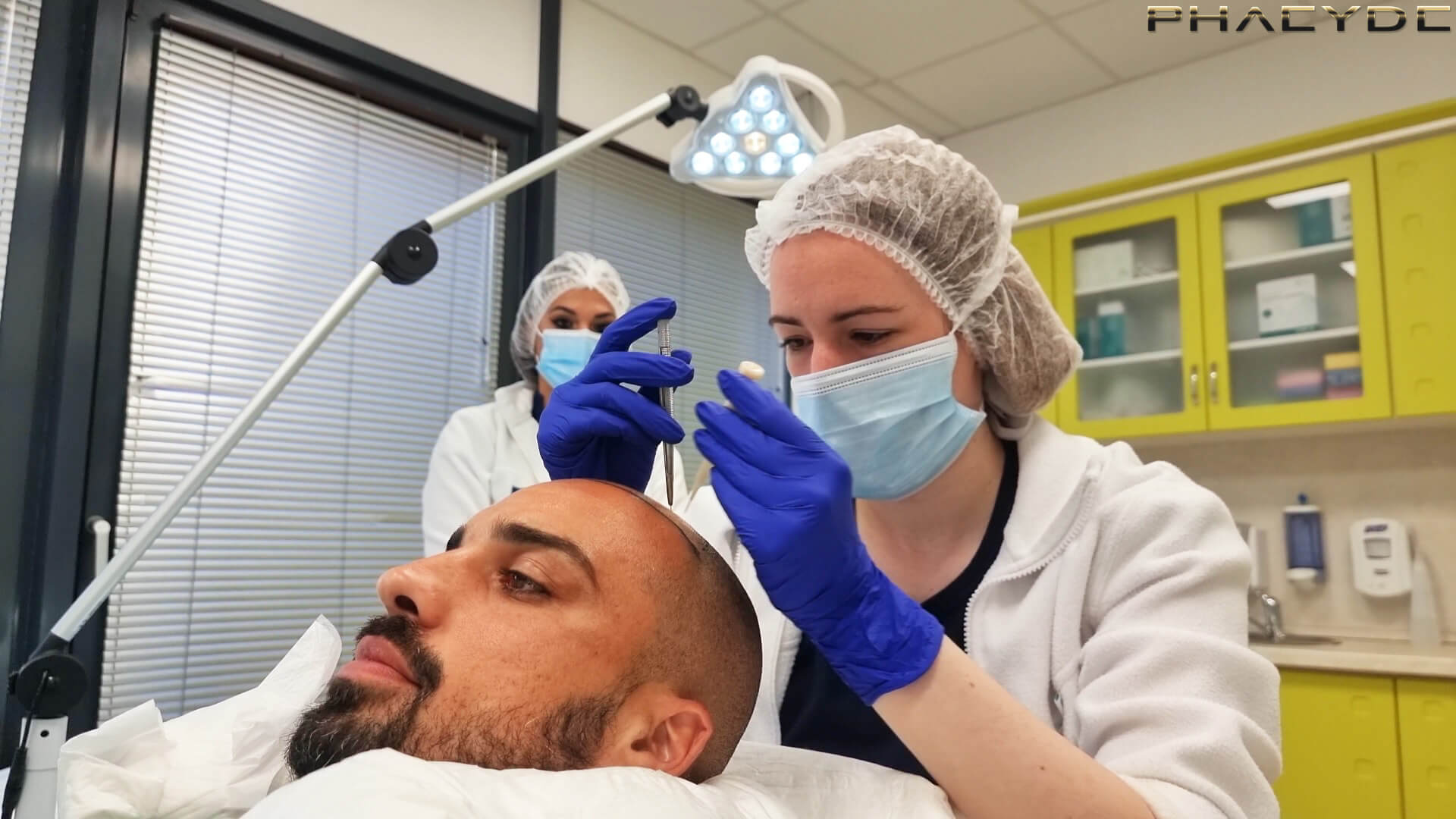 Ako dlho je potrebné zostať doma po transplantácii vlasov? - PHAEYDE Clinic