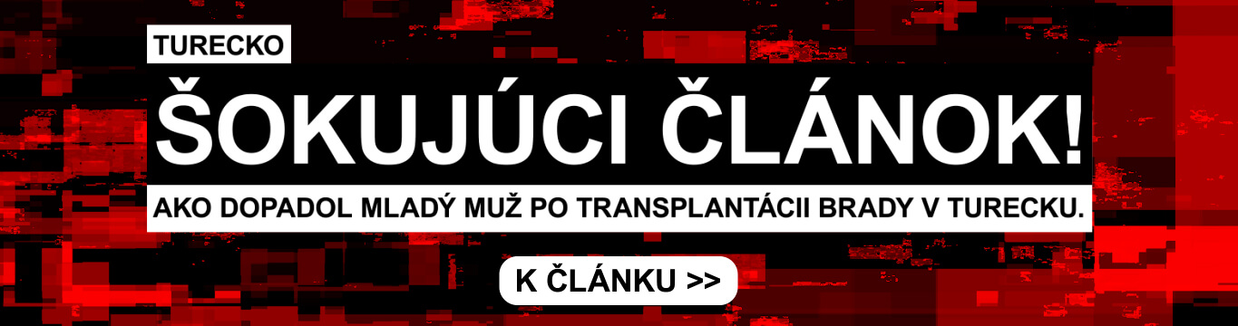 Hair transplant at the PHAEYDE clinic in Budapest