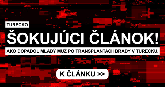 Hair transplant at the PHAEYDE clinic in Budapest