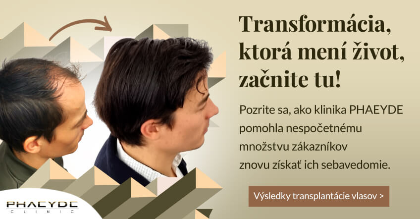 Transformácia, ktorá mení život, začnite tu! - PHAEYDE Clinic Transplantácia vlasov Bratislava