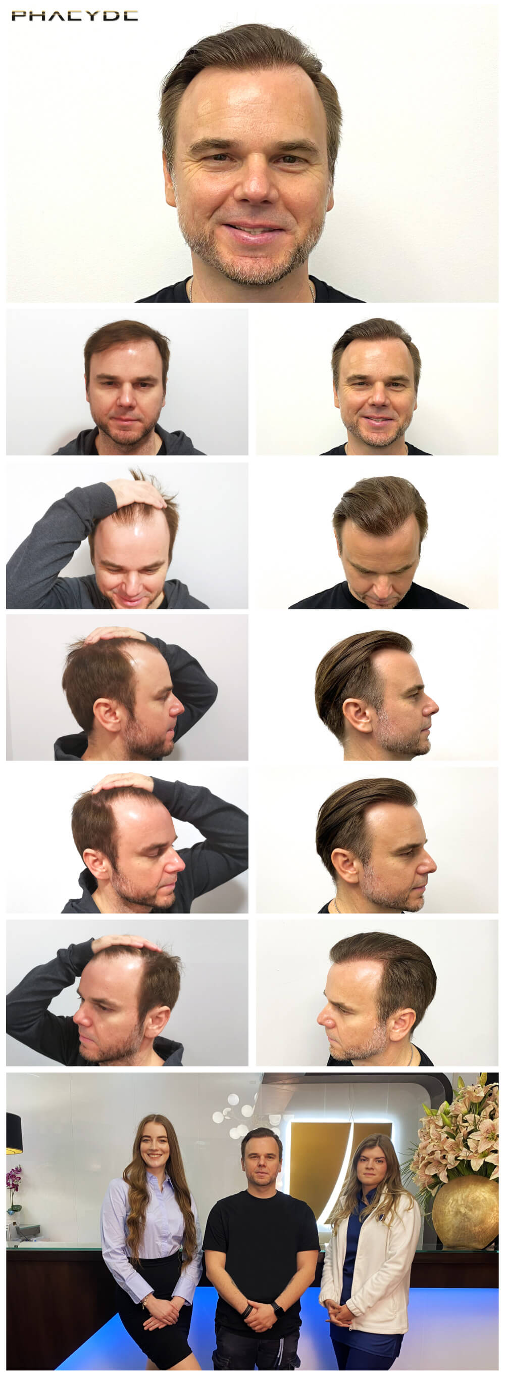 G. J. – 4800 Štepy