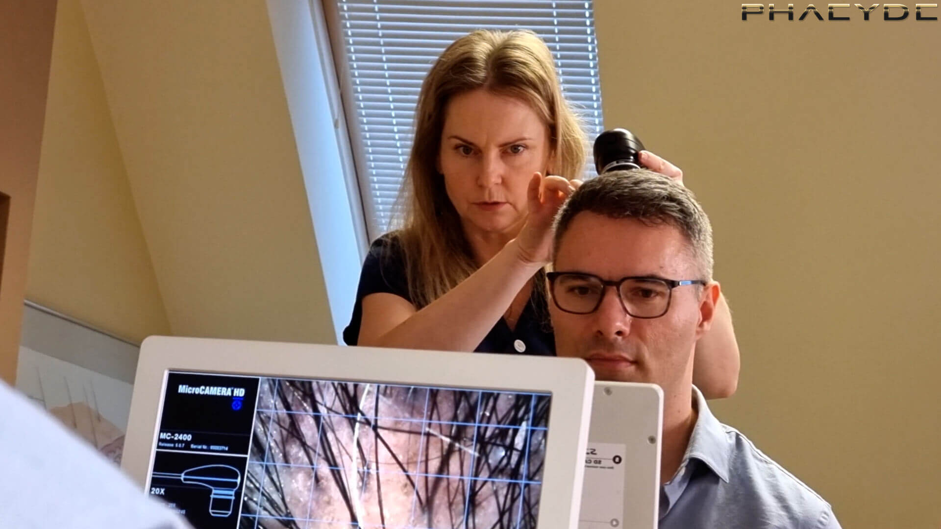 Po transplantácii vlasov: Pavel - PHAEYDE Clinic