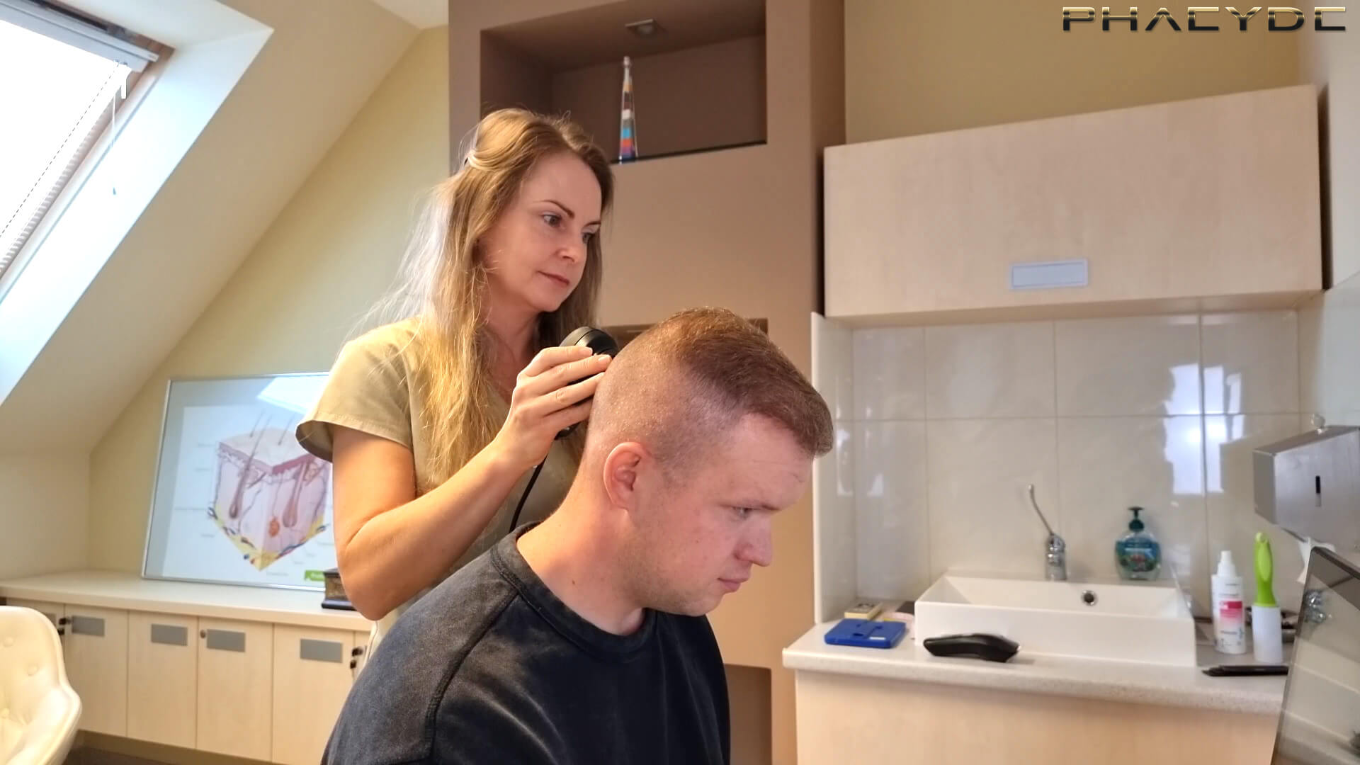 Transplantácia vlasov - PHAEYDE Clinic